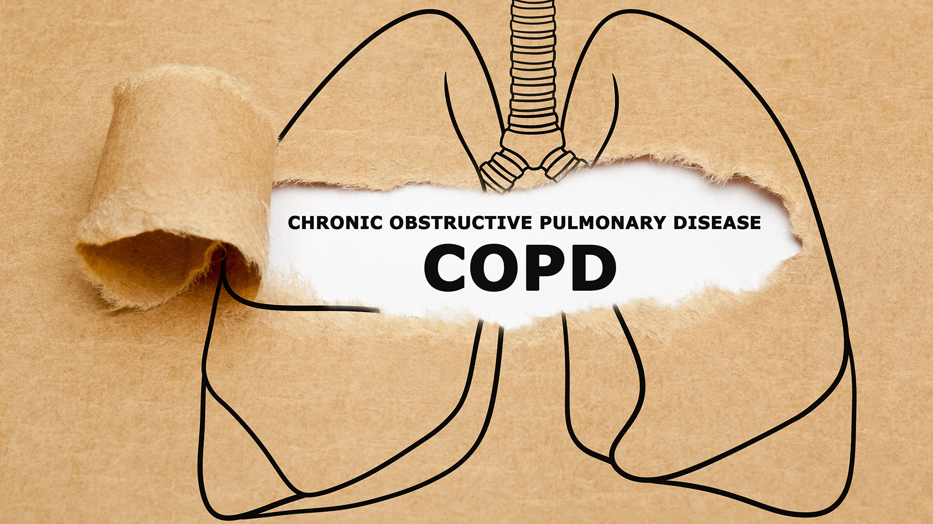 North Jersey Pulmonary Associates | Smoking   Vaping, Sleep Apnea and Pneumonia